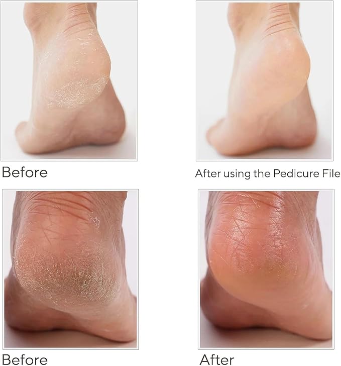 Spa-Rific 3pc Nano File and Ultra Wide Jaw Nail Clipper Set: Glass Nail Files with Large Nail Clipper and Metal Case Kit - Crystal Fingernail Manicure and Pedicure Tools - Yellow Indigo Ombre