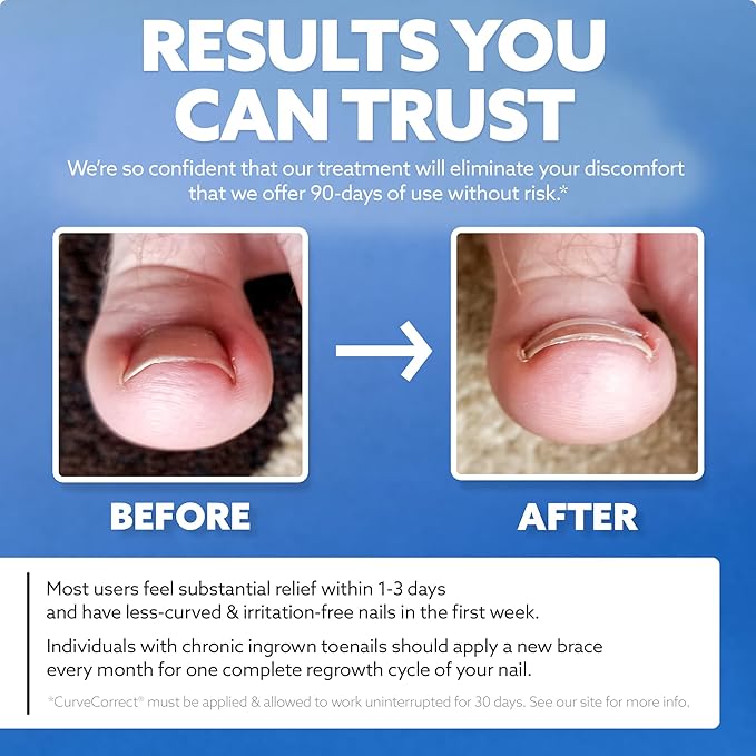 CurveCorrect® Ingrown Toenail Treatment Kit - Ingrown Toenail Corrector Kit with 10 Braces - at Home Ingrown Toenail Correction - Big Toe Ingrown Nail Removal